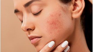 Avoid These 7 Most Common Skincare Mistakes That Are Ruining Your Skin