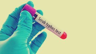 Uttar Pradesh: Scrub Typhus Cases Found in Unnao District
