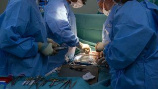 Hyderabad Doctors Remove Record 156 Kidney Stones From Single Patient by 'Keyhole Surgery'