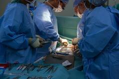 Hyderabad Doctors Remove Record 156 Kidney Stones From Single Patient by Keyhole Surgery