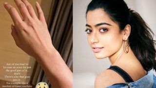 Rashmika Mandanna Gives a Glimpse of Her Laser Treatment on Arms, Says 'It’s Not Easy To Be An Actor'