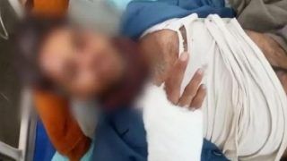 Rajasthan: RTI Activist Who Exposed Illegal liquor Trade Attacked, Legs Pierced With Nails