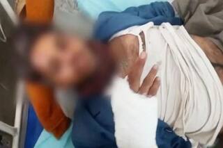 Rajasthan: RTI Activist Who Exposed Illegal liquor Trade Attacked, Legs Pierced With Nails