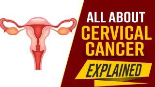 Explained: What Is Cervical Cancer? Early Signs, Causes, Symptoms And Treatment, Everything You Need To Know; Watch Video