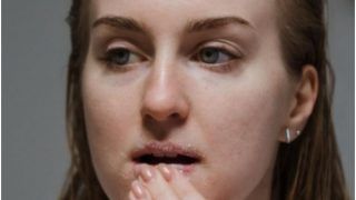 Skincare Tips: 3 Easy Ways to Prevent Chapped Lips This Winter Season