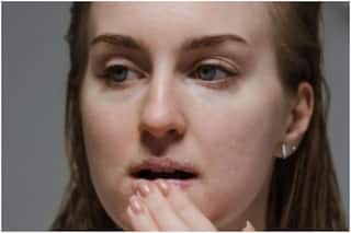 Skincare Tips: 3 Easy Ways to Prevent Chapped Lips This Winter Season