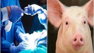 Pig Kidney Transplant in Human: डॉक्टरों ने इंसान के शरीर में लगा दी सुअर की किडनी, तुरंत काम भी करने लगीं
