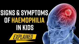 World Hemophilia Day 2022: Know What It Is And How Does It Affect Children, Explained By Expert - Watch
