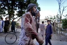Suicide Bomber Kills 50 Worshippers During Friday Prayers At Kabul Mosque, Several Injured