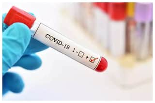 Delhi Records 357 Fresh Covid Cases, Decline From Previous Day; No Death Reported