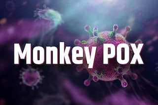 First Monkeypox Death Reported in Nigeria; 21 Cases Confirmed
