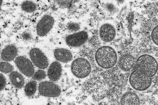 What is Monkey Pox? Should India be Worried? All You Need to Know