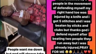 Tanzanian Internet Sensation Kili Paul Attacked With Knife, Beaten With Sticks