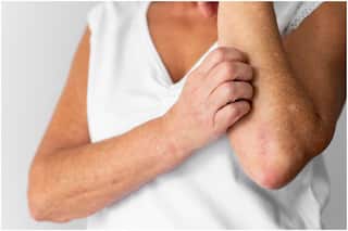 Diabetes Symptoms: How Your Skin Can Warn You Before It's Too Late to Reverse Diabetes!