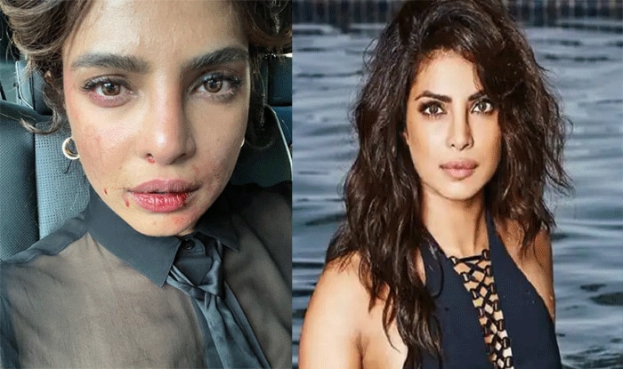 प्रियंका चोपड़ा के चेहरे पर खून के निशान देखकर परेशान हुए फैंस, एक मां की खून भरी फोटो हुई वायरल