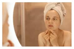 White Spot on Your Skin? It Could be Sign of These 3 Skin Conditions