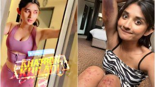 Khatron Ke Khiladi 12: Kanika Mann Badly Injured While Performing A Stunt, Flaunts Bruised Arms & Legs With A Smile, Fans Say 'More Power To You'