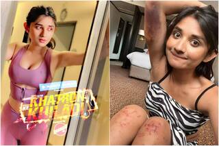 Khatron ke Khiladi 12: स्टंट करते समय घायल हुईं कनिका मान, जख्मी हाथ-पैर देखकर फैंस ने कहा 'असली खिलाड़ी'