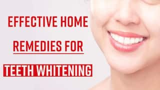 Oral Care Tips: Struggling With Yellow Teeth? Do Try These Simple And Effective Home Remedies - Watch Video