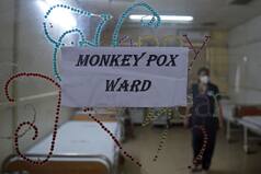 Monkeypox: Delhi's 2nd Suspect With Travel History Admitted To LNJP Hospital; Niti Aayog Says No Need To Panic