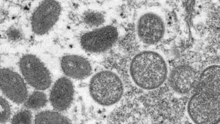 Israel Reports 11 New Monkeypox Cases, Total at 66