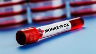 San Francisco Becomes First Major US City To Announce Monkeypox Local Emergency