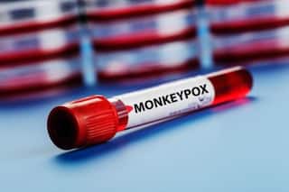 WHO Renames Monkeypox As 'Mpox'. Find Out Why