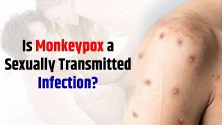 Can You Contract Monkeypox Through Sex? Here’s What Expert Has to Say