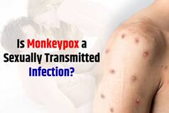 Can You Contract Monkeypox Through Sex? Here's What Expert Has to Say
