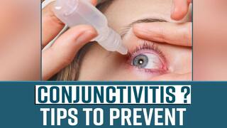Conjunctivitis Symptoms? Here's How You Can Prevent Conjunctivitis in Summers - Watch Video