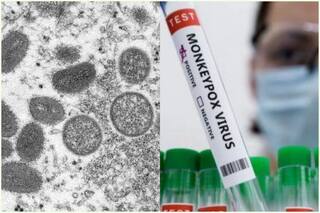 EXPLAINED: Will Monkeypox Spread Like COVID in India?