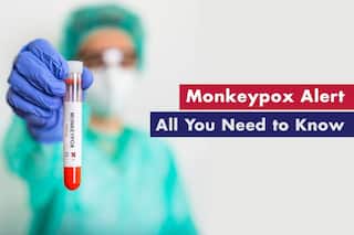 Monkeypox Alert: All You Need To Know About The Disease