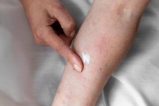 शरीर में दाने और खुजली होने का कारण? ये 4 उपाय हैं इस समस्या का हल