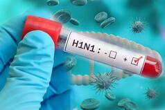 Jharkhand: 3 Tested Positive For Swine Flu in Ranchi Hospital,Had Symptoms Like COVID-19