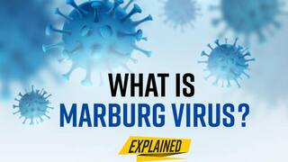 Marburg Virus: What Is It? Symptoms, Treatment And Precautions, All You Need To Know - Watch Video