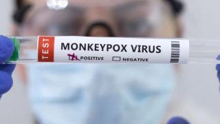 Delhi Reports 9th Monkeypox Case, India's Total Tally At 14