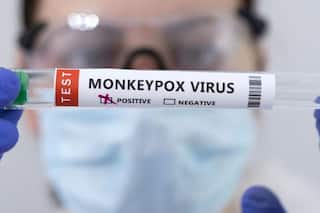 Monkeypox: 8 साल या इससे कम उम्र के बच्चों में मंकीपॉक्स का खतरा ज्यादा