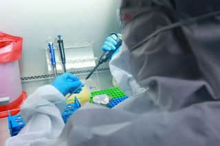 Delhi Reports 8th Monkeypox Case, Patient Admitted to LNJP Hospital; Total Tally Rises to 13 in India