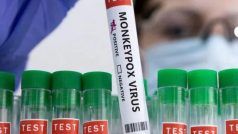 Monkeypox: देश की पहली स्वदेशी टेस्ट किट लॉन्च, संक्रमण का जल्द पता लगाने में होगी मदद