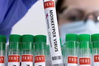 Monkeypox A.2 Strain in India: How is it Different From B.1 Strain? All You Need to Know