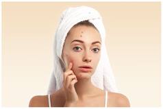 Protect Your Skin From Humidity With These Skincare Tips