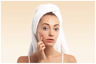 Protect Your Skin From Humidity With These Skincare Tips