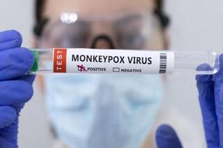 New Monkeypox Strain Identified In UK, Infected Patient Admitted To Hospital