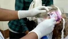 Bizarre! Woman's Head Wound Dressed With Condom Wrapper in MP's Morena