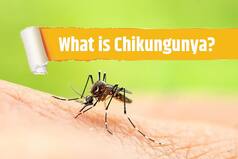 What is Chikungunya, Its Symptoms And Causes? All You Need to Know About Mosquito-Borne Disease