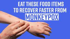 Monkeypox Diet: Top 5 Foods That Will Boost Immunity And Help You Recover Faster From Monkeypox - Watch Video