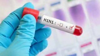 Swine Flu In India: इस साल स्वाइन फ्लू के मामले तेजी से बढ़े हैं, जानिए इसके पीछे क्या है वजह