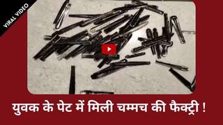 Unique News: युवक के पेट से निकली 63 चम्मच, सच जानकर हैरान रह जाएंगे आप | देखें वीडियो