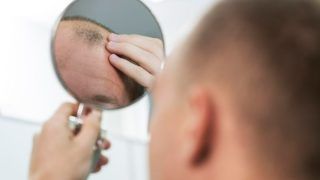 Male Pattern Baldness: What Causes Hair Loss in Men And How it Can be Treated?