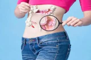 Colorectal Cancer: आंत के कैंसर में उम्मीद का सूरज बनकर आई नई दवा, दिख रहे शानदार नतीजे